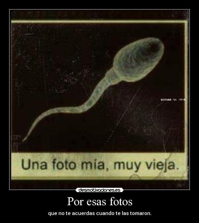 Por esas fotos -