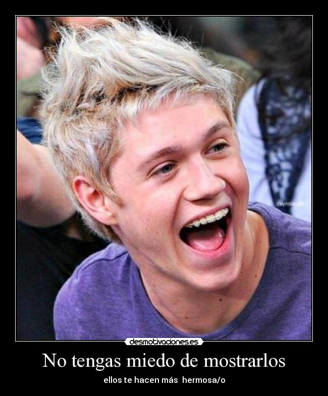 No tengas miedo de mostrarlos - ellos te hacen más hermosa/o
