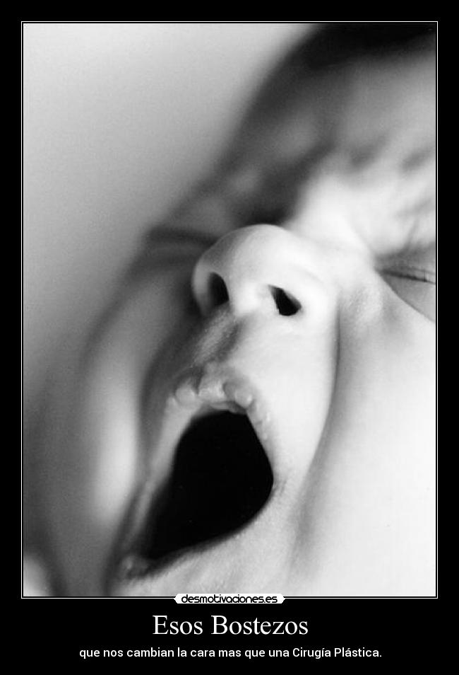 Esos Bostezos -