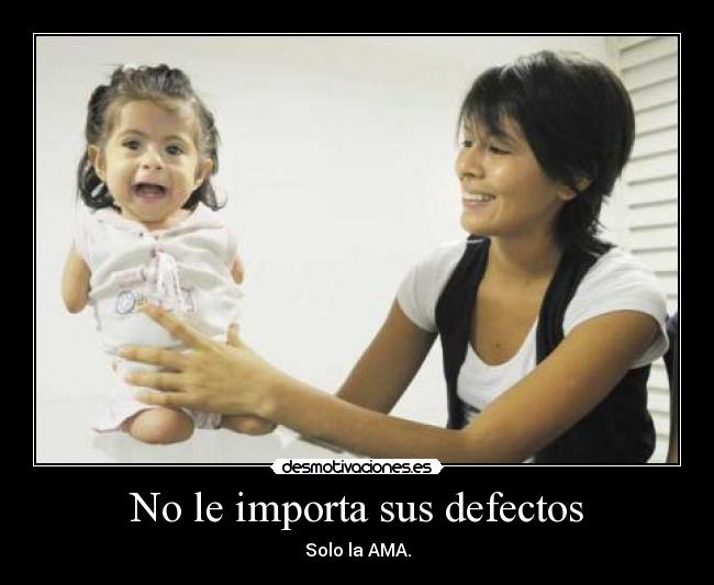No le importa sus defectos - 