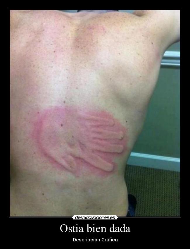 Ostia bien dada - 