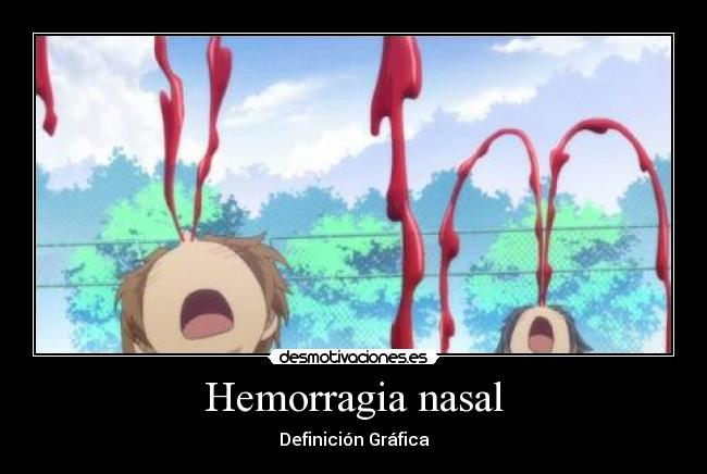Hemorragia nasal - Definición Gráfica