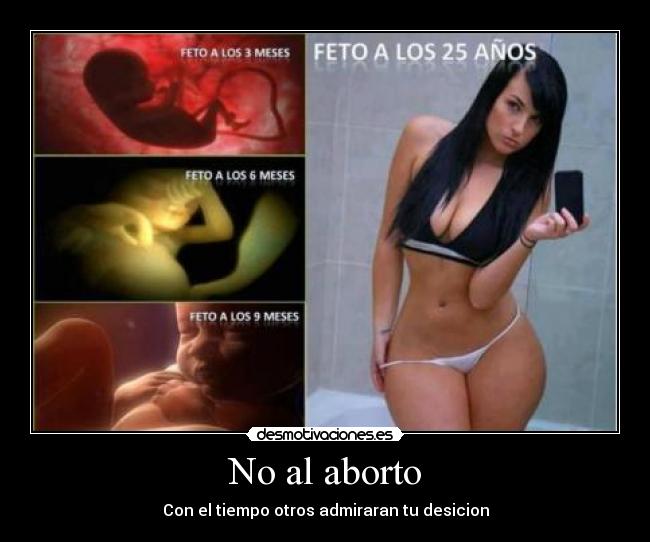 No al aborto - Con el tiempo otros admiraran tu desicion