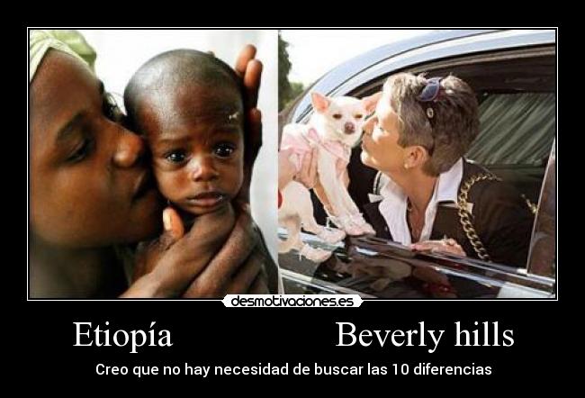 Etiopía                  Beverly hills - Creo que no hay necesidad de buscar las 10 diferencias