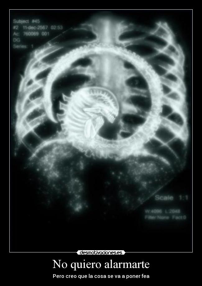No quiero alarmarte - Pero creo que la cosa se va a poner fea