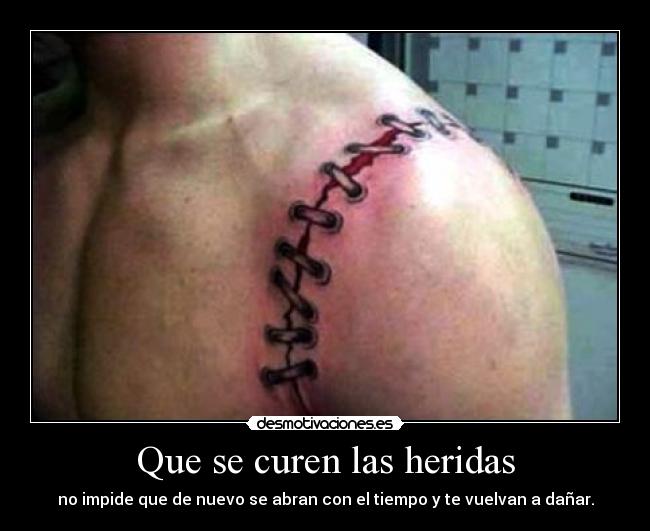 Que se curen las heridas - no impide que de nuevo se abran con el tiempo y te vuelvan a dañar.