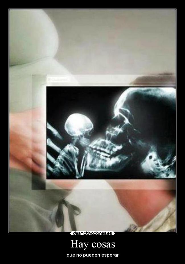 Hay cosas -