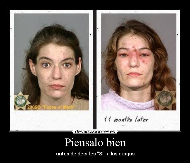 Piensalo bien - antes de decirles SI a las drogas