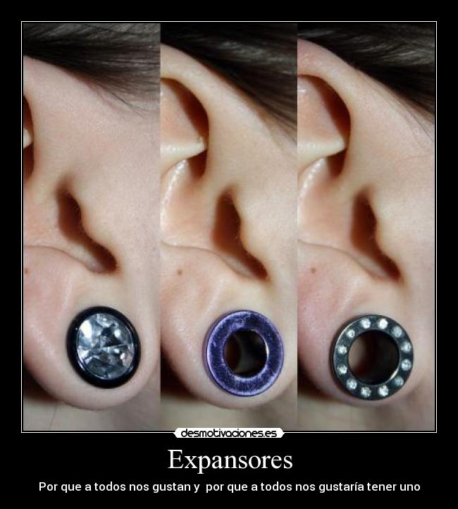 Expansores - Por que a todos nos gustan y por que a todos nos gustaría tener uno