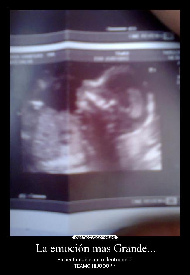 La emoción mas Grande... - Es sentir que el esta dentro de ti ♥
TEAMO HIJOOO *.*