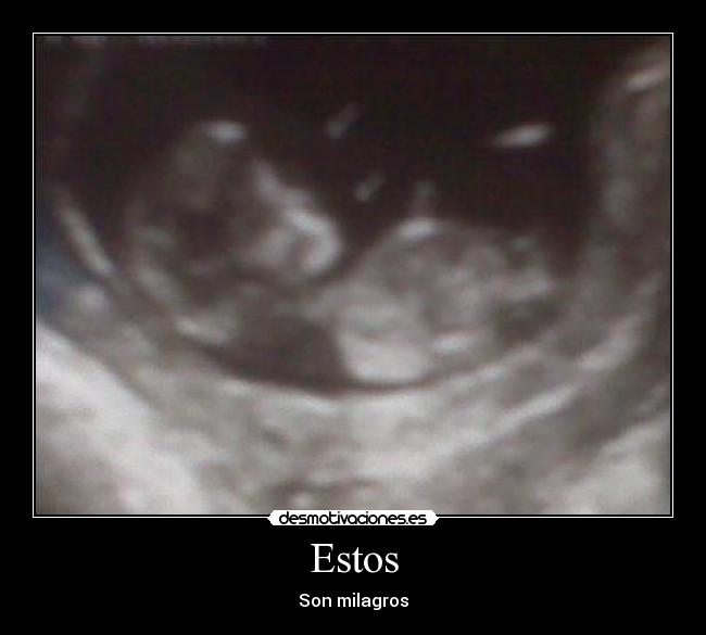 Estos - Son milagros