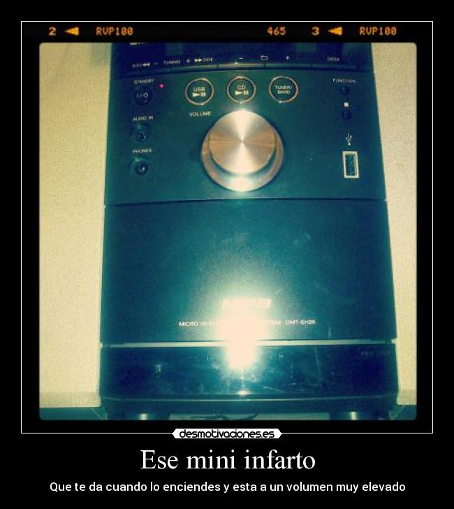 Ese mini infarto - 