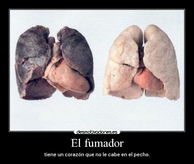 El fumador - tiene un corazón que no le cabe en el pecho.