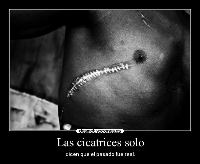 Las cicatrices solo - 