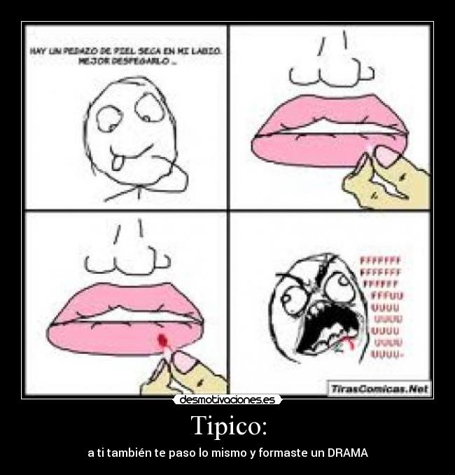 Tipico: - 