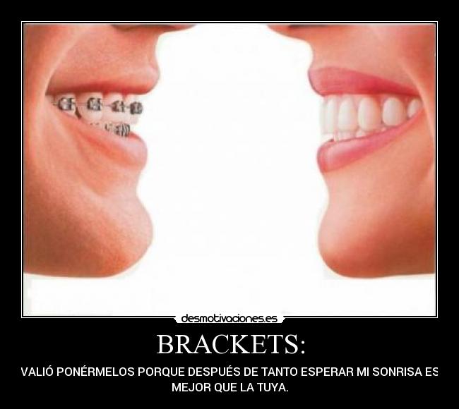 Brackets beso Imagui