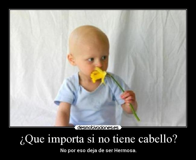 ¿Que importa si no tiene cabello? - No por eso deja de ser Hermosa.