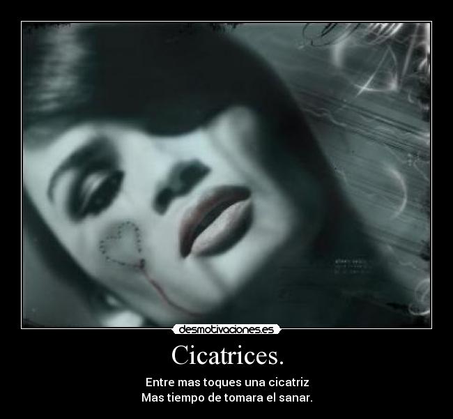 Cicatrices. - 