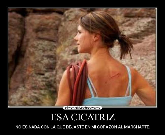 ESA CICATRIZ - NO ES NADA CON LA QUE DEJASTE EN MI CORAZON AL MARCHARTE.