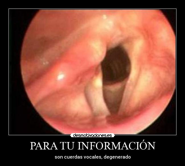 carteles cuerdas vocales desmotivaciones