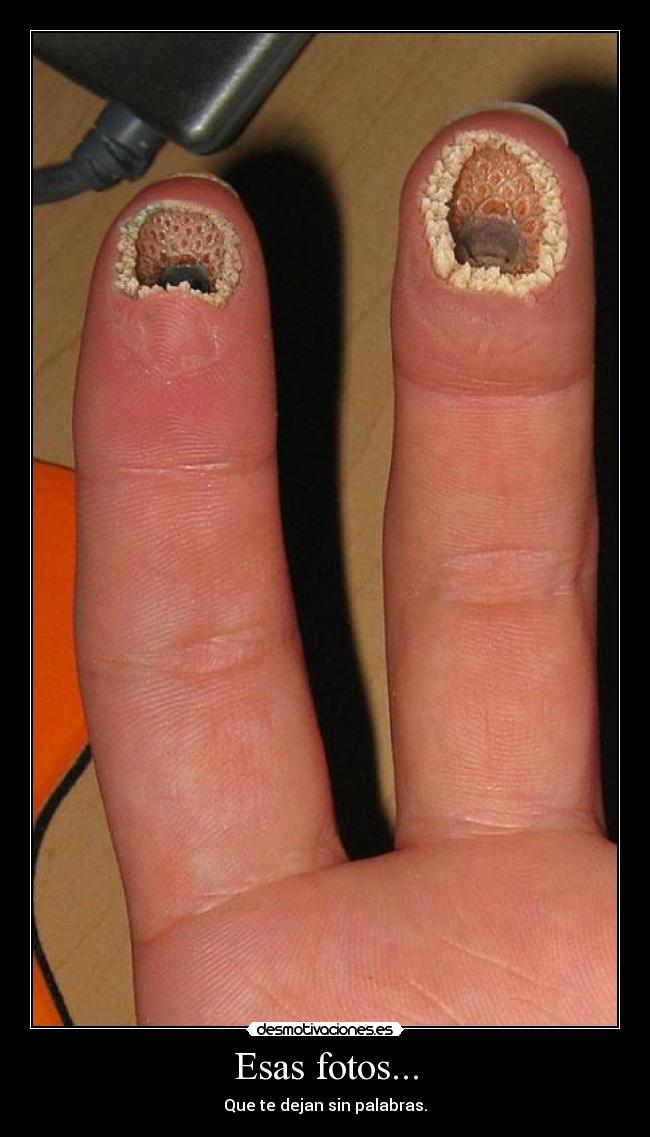 Esas fotos... - Que te dejan sin palabras.