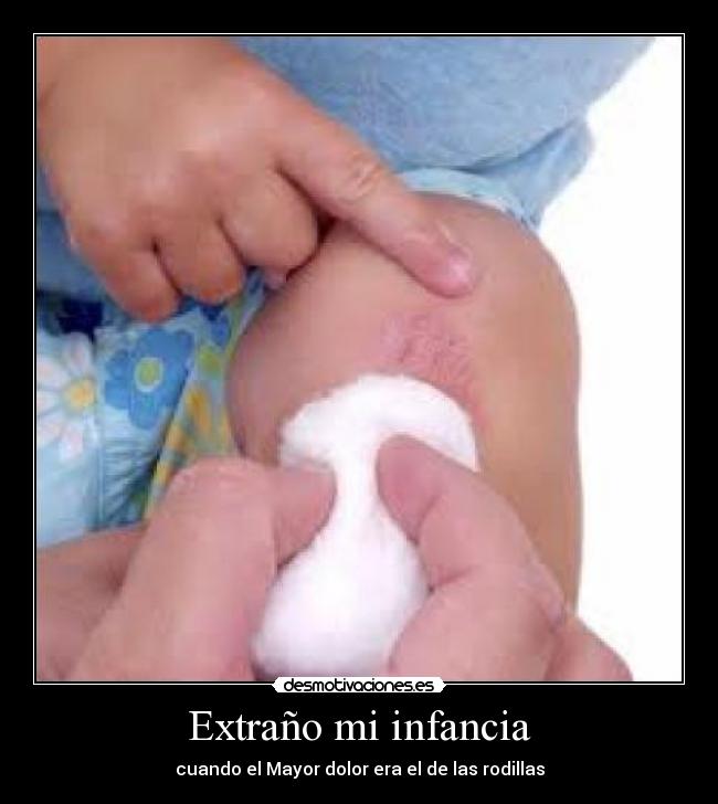 Extraño mi infancia - cuando el Mayor dolor era el de las rodillas