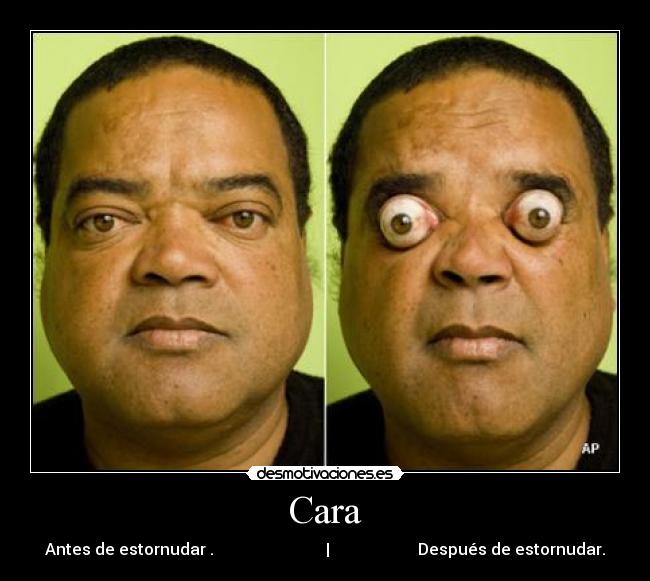 Cara - Antes de estornudar . | Después de estornudar.