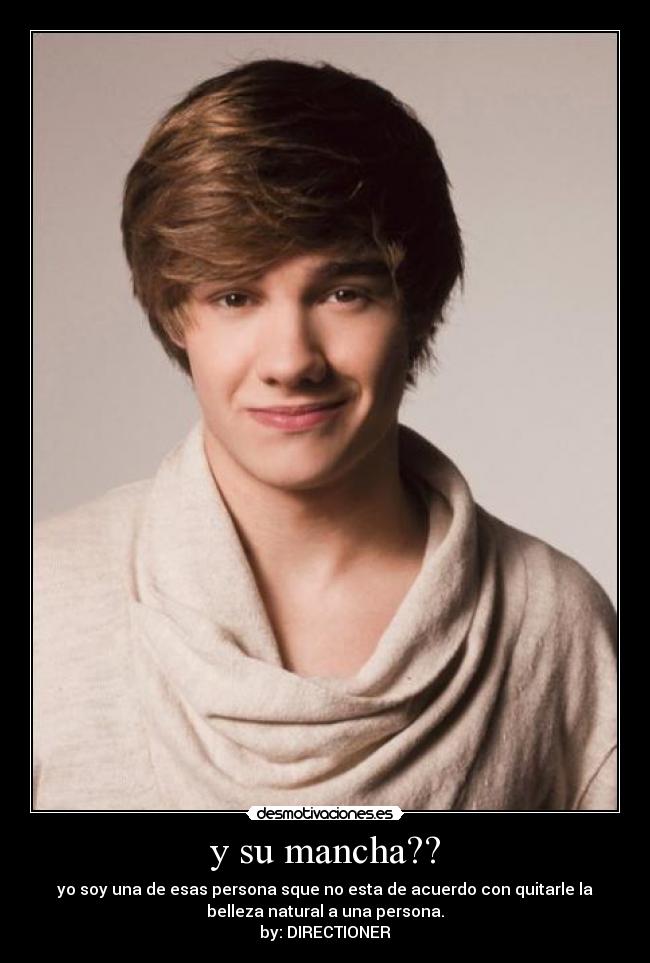 y su mancha?? - yo soy una de esas persona sque no esta de acuerdo con quitarle la
belleza natural a una persona.
by: DIRECTIONER