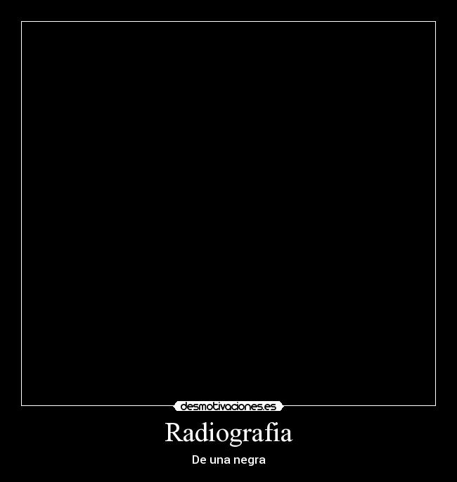Radiografia - De una negra