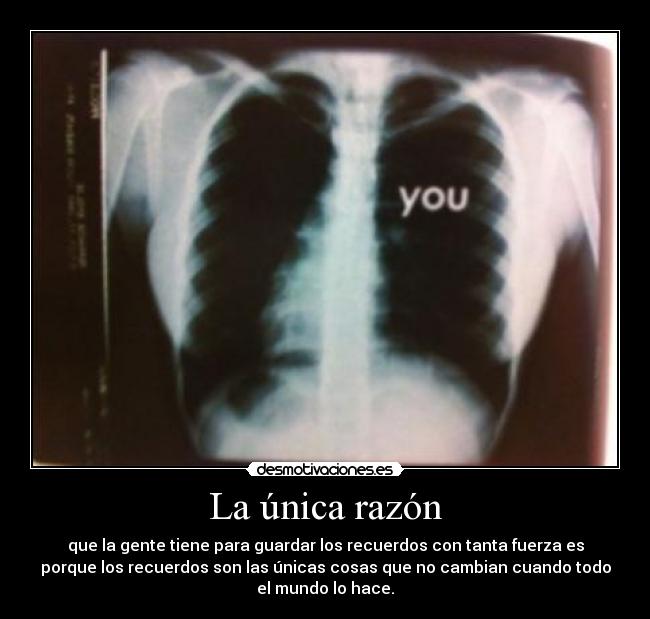 La única razón -