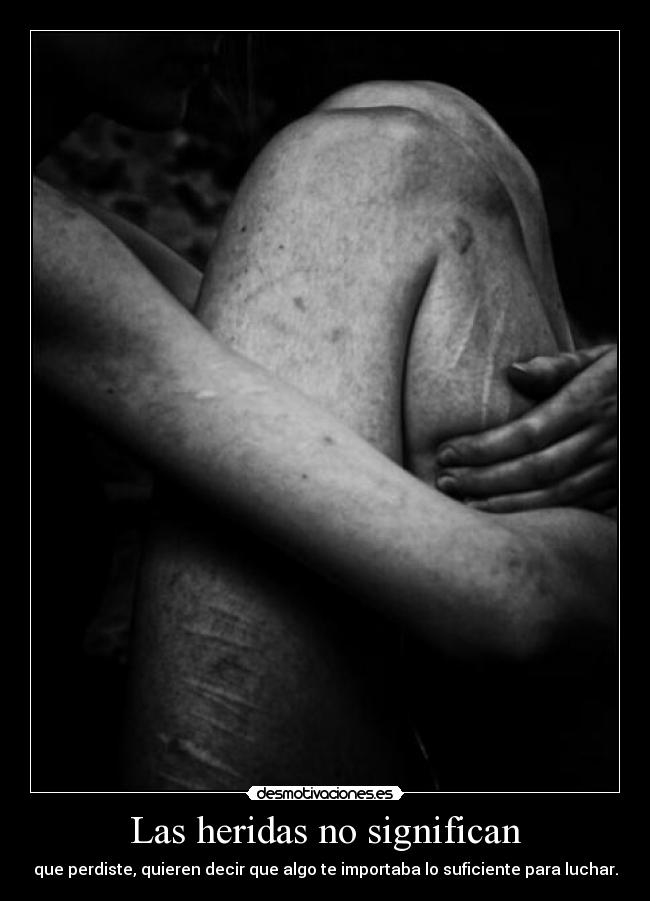 Las heridas no significan - que perdiste, quieren decir que algo te importaba lo suficiente para luchar.