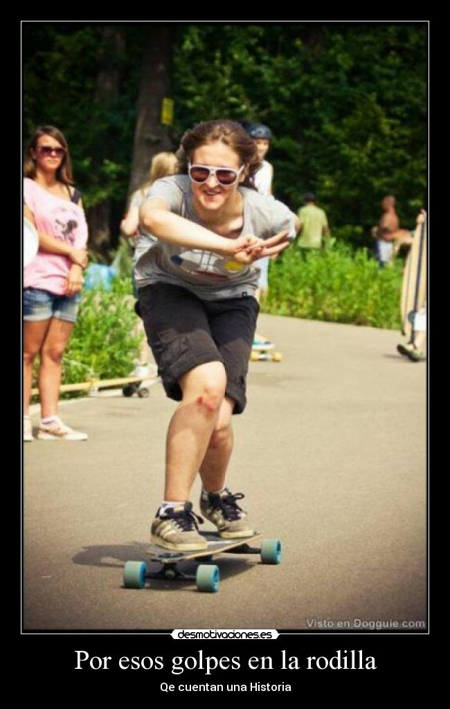 Por esos golpes en la rodilla - Qe cuentan una Historia
