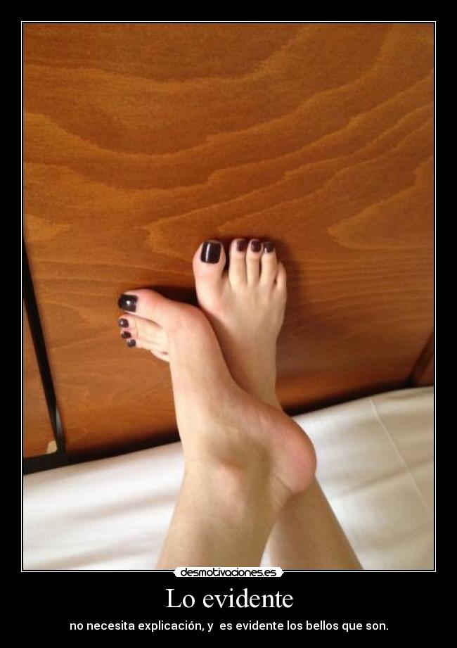Lo evidente - no necesita explicación, y  es evidente los bellos que son.
