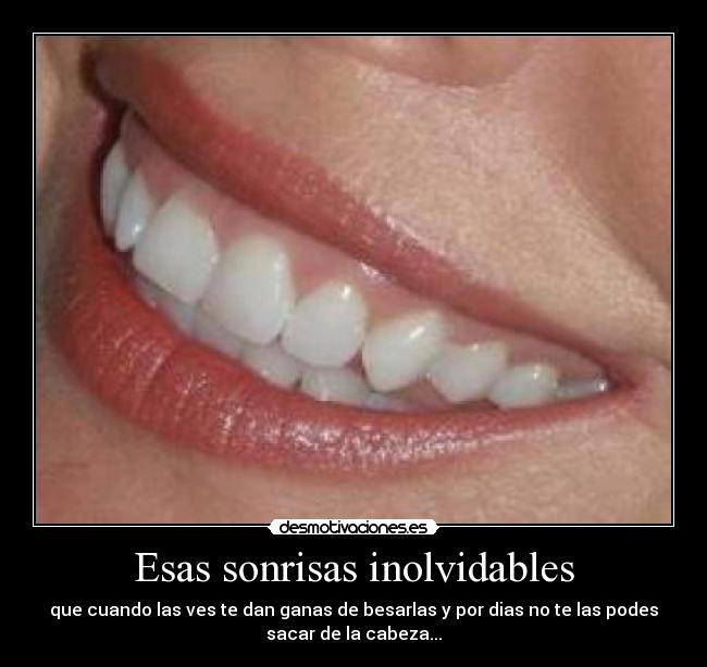 Esas sonrisas inolvidables - que cuando las ves te dan ganas de besarlas y por dias no te las podes
sacar de la cabeza...
