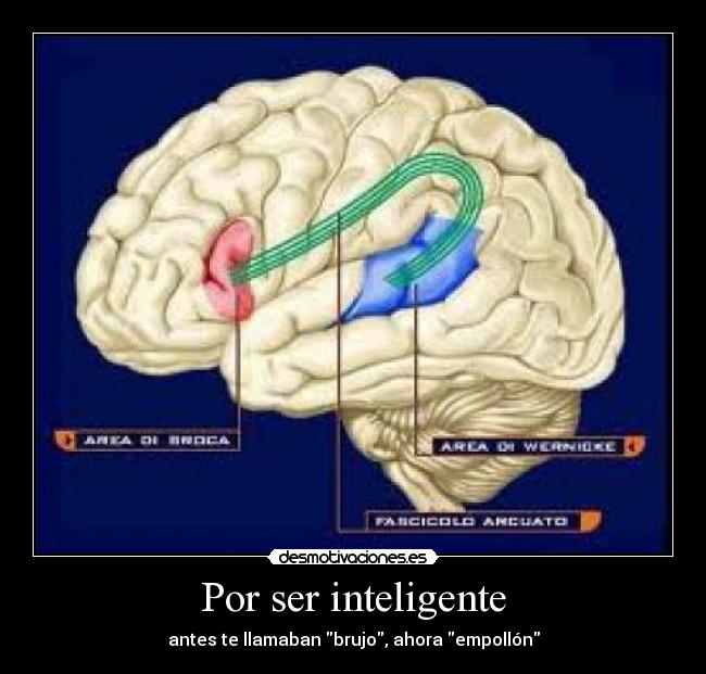 Por ser inteligente -