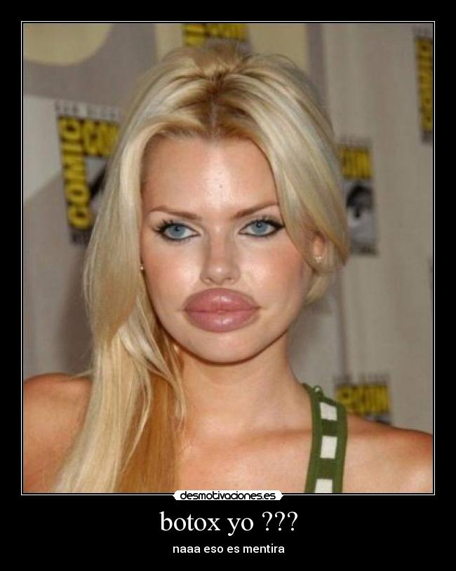 botox yo ??? - 