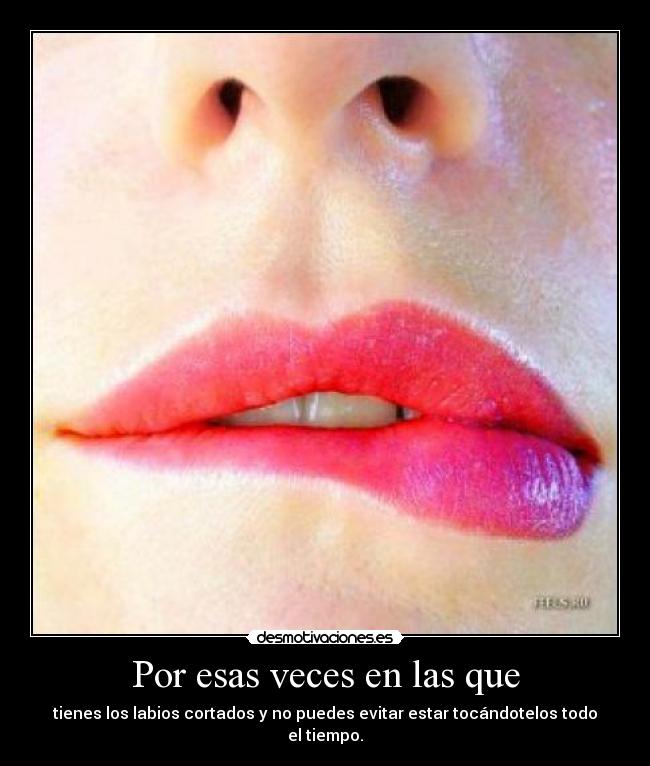 Por esas veces en las que - tienes los labios cortados y no puedes evitar estar tocándotelos todo el tiempo.