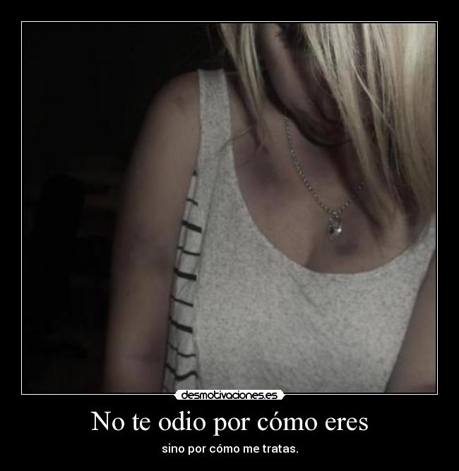 No te odio por cómo eres -
