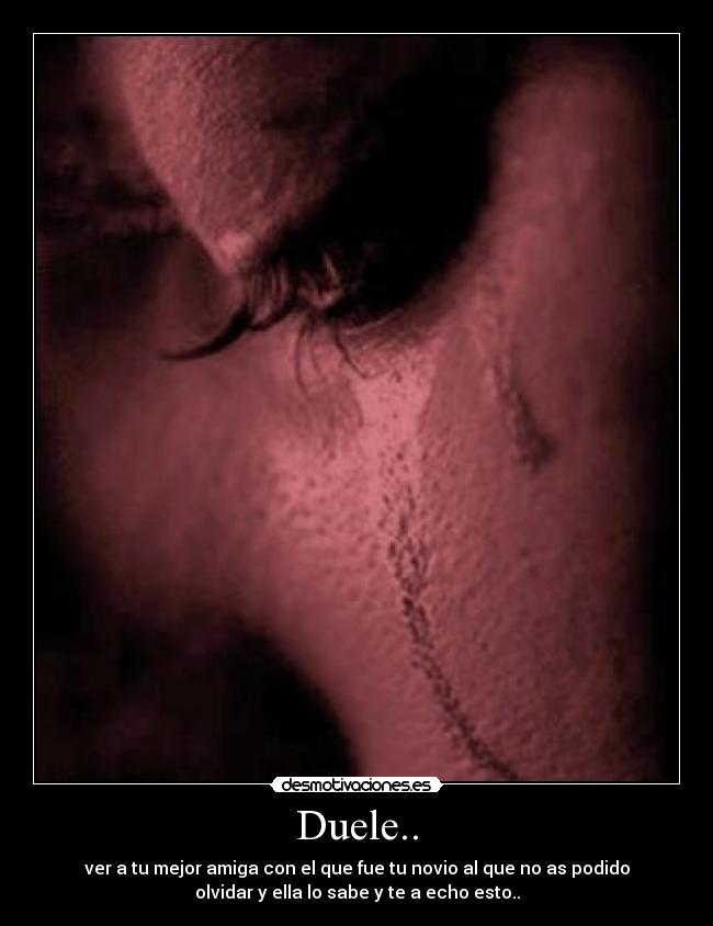 Duele.. -