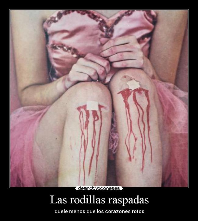 Las rodillas raspadas - duele menos que los corazones rotos
