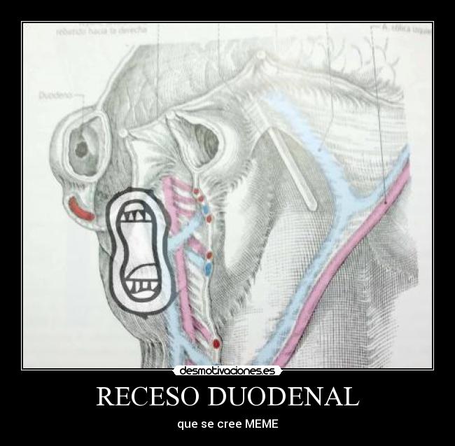 RECESO DUODENAL -