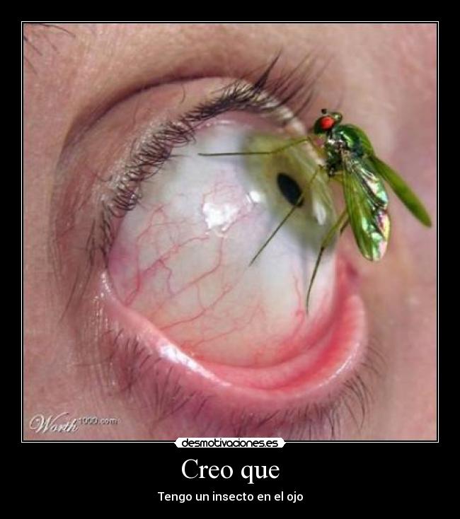 Creo que - Tengo un insecto en el ojo