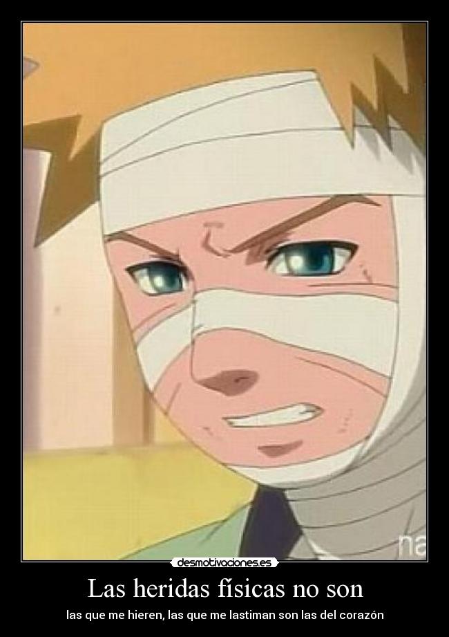 Las heridas físicas no son -