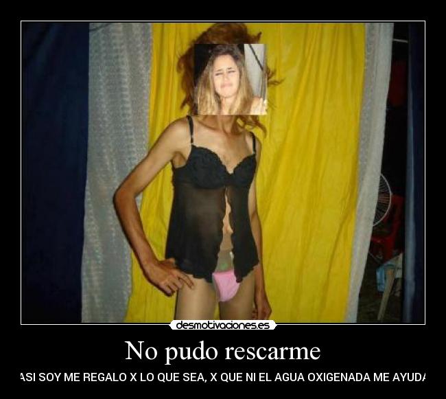 No pudo rescarme - ASI SOY ME REGALO X LO QUE SEA, X QUE NI EL AGUA OXIGENADA ME AYUDA