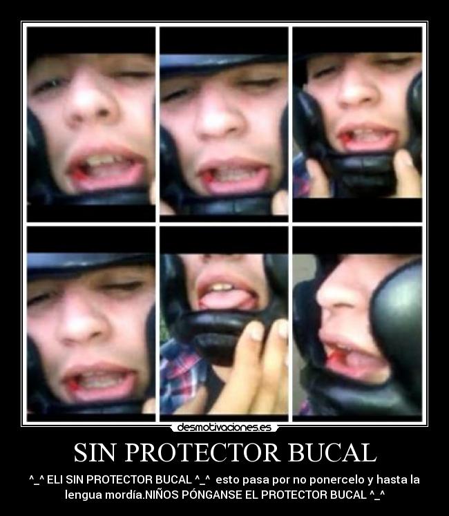 Imágenes, Carteles y Desmotivaciones de sin protector bucal Imágenes, Carteles y Desmotivaciones de sin protector bucal