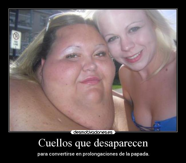 Cuellos que desaparecen - para convertirse en prolongaciones de la papada.