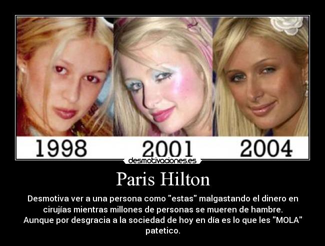 Paris Hilton - Desmotiva ver a una persona como estas malgastando el dinero en
cirujías mientras millones de personas se mueren de hambre.
Aunque por desgracia a la sociedad de hoy en día es lo que les MOLA
patetico.