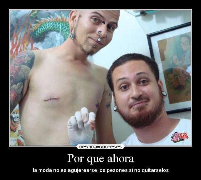 Por que ahora - la moda no es agujerearse los pezones si no quitarselos