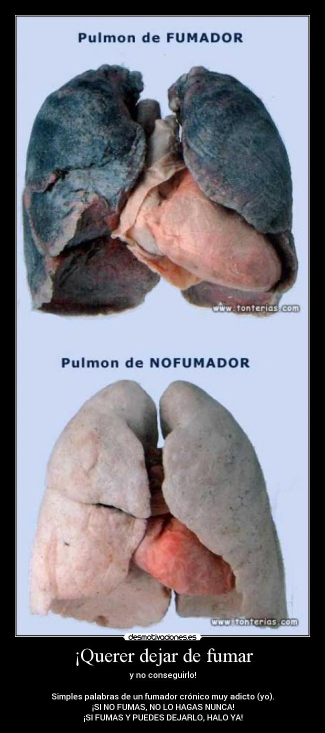 ¡Querer dejar de fumar - 