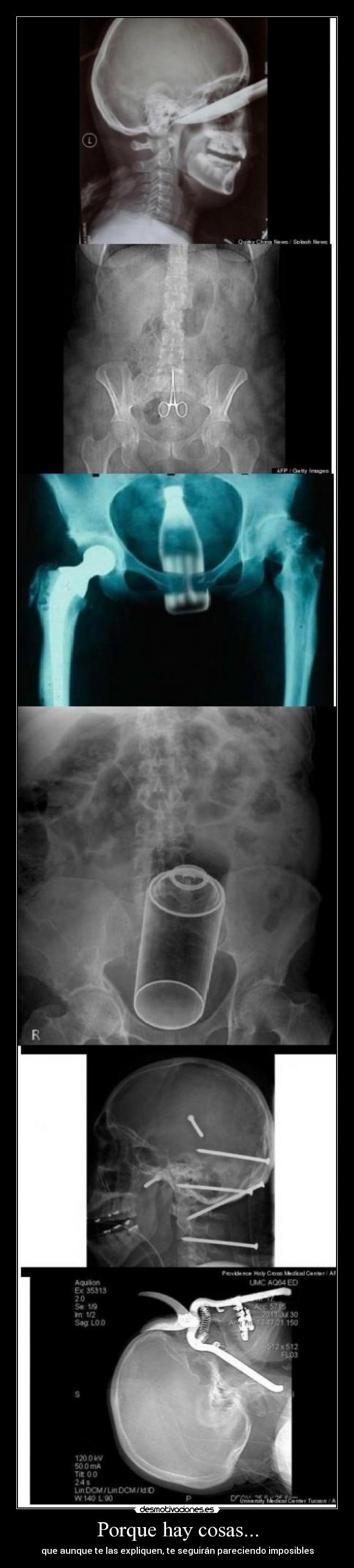 carteles radiografia locura explicar cosas vida explicacion desmotivaciones